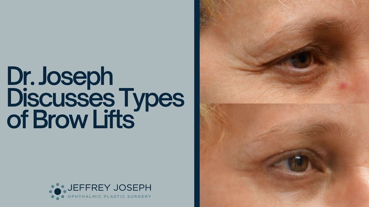 Different Types of Brow Lifts Explained | Which Brow Lift Technique is Right for You?