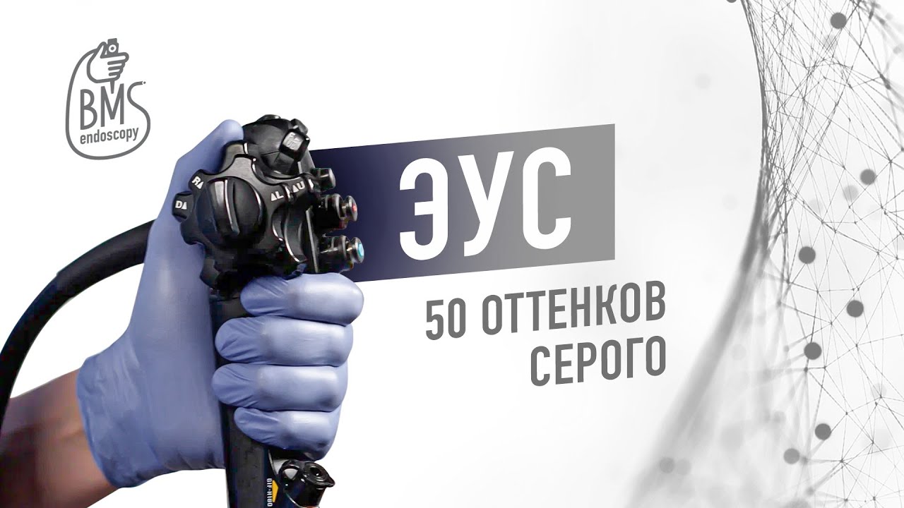 Эндосонография: ГИПЕРЭХОГЕННОСТЬ, ИЗОЭХОГЕННОСТЬ, ГИПОЭХОГЕННОСТЬ, АНЭХОГЕННОСТЬ #ЭУС, #ЭХОэндоскоп