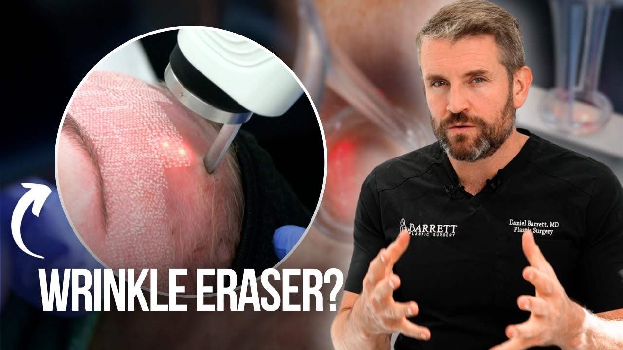 Why CO2 Laser Is the Ultimate Skin Fix!