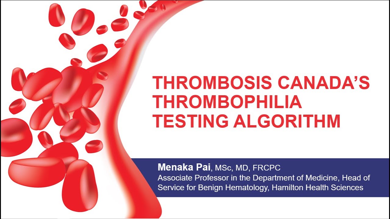 Thrombosis Canada's Thrombophilia Testing Algorithm