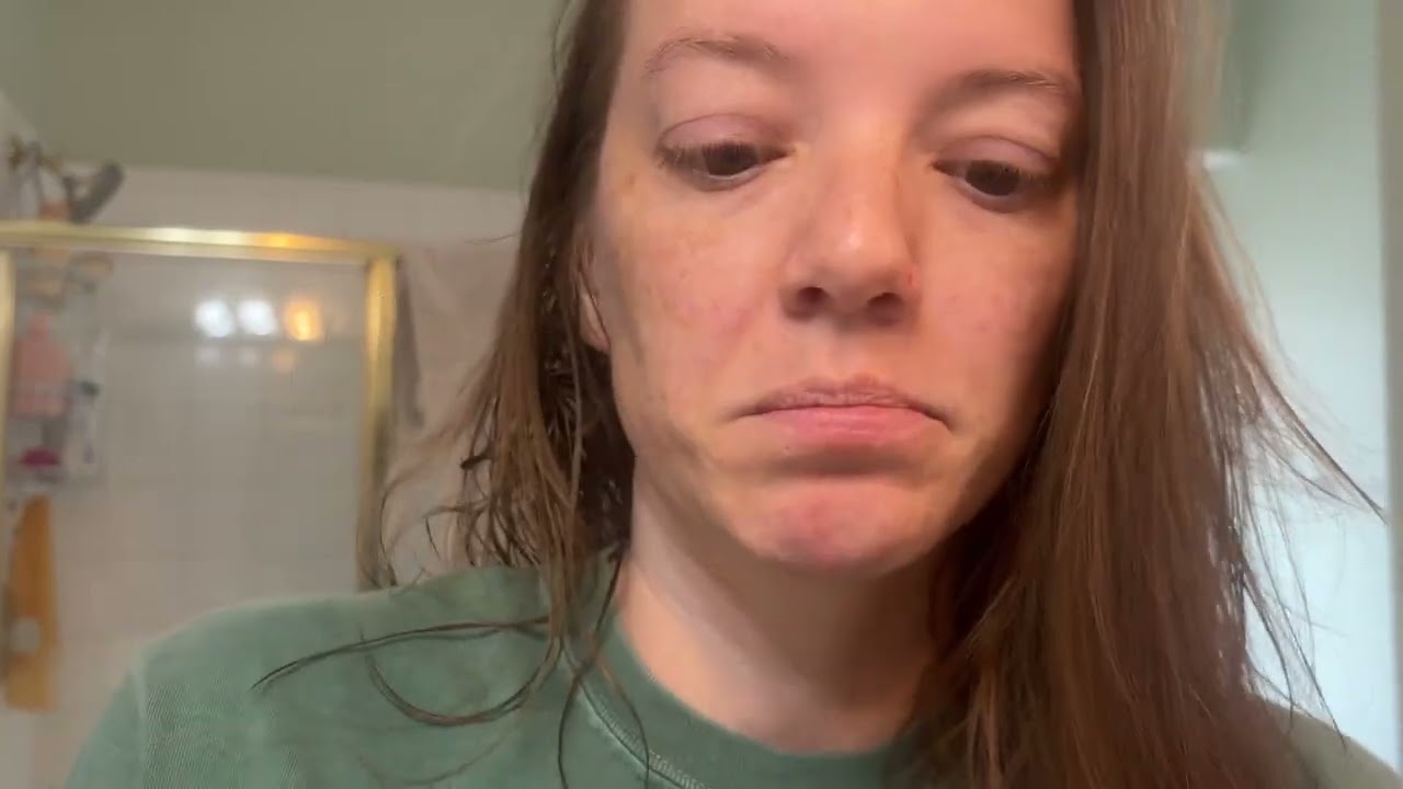 Watch this before buying Medicube Vitamin C pads.