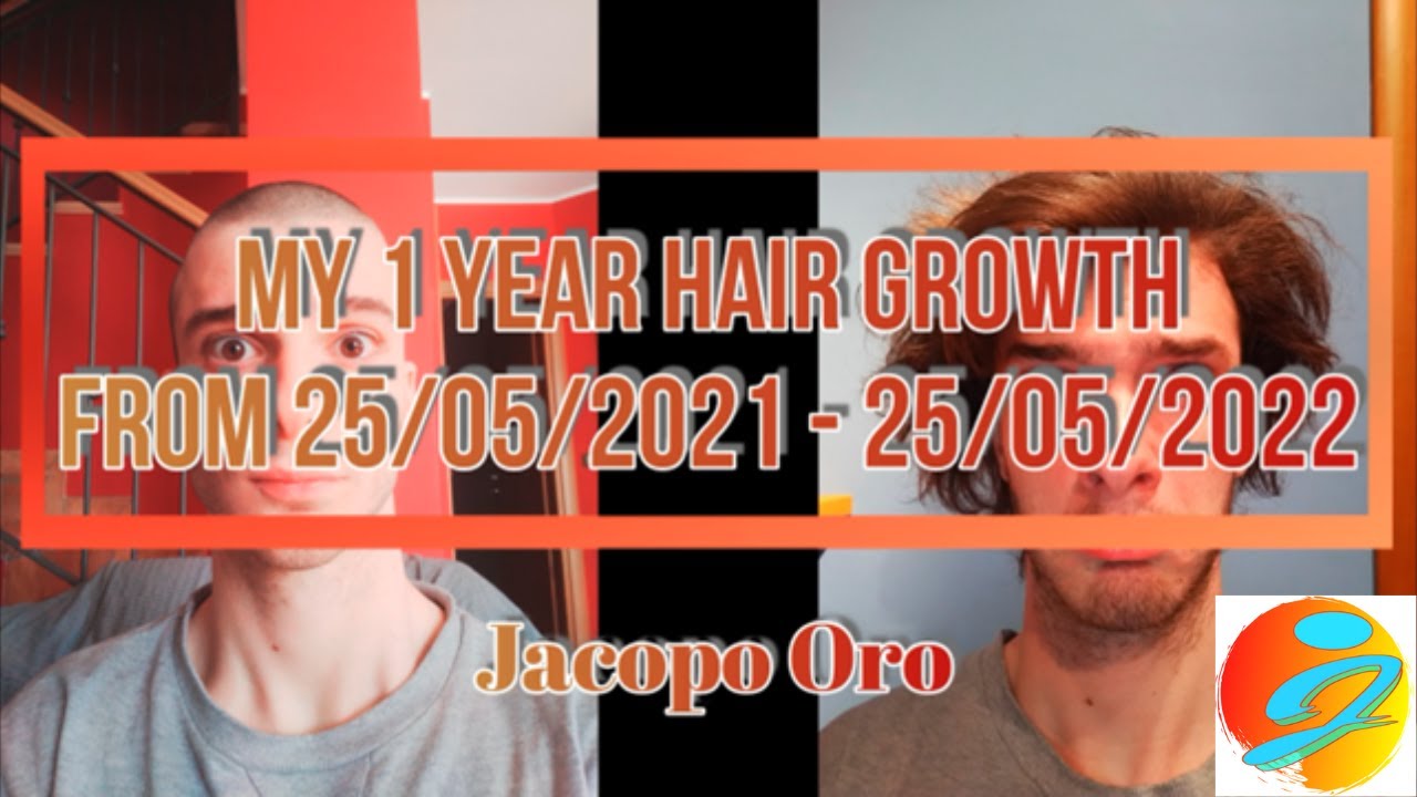 1 YEAR HAIR GROWTH. 365 Photos!!! (crescita capelli). (ITA SUB) || Jacopo Oro