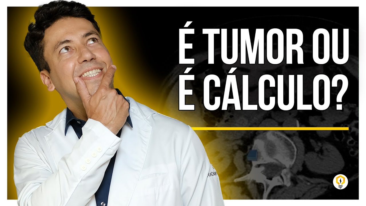 Como Diferenciar TUMOR no COLÉDOCO de COLEDOCOLITÍASE