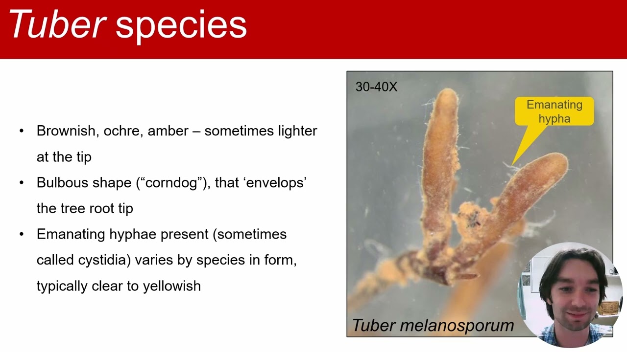 How to Examine Tree Roots Under a Microscope for the Presence of Tuber Ectomycorrhizae
