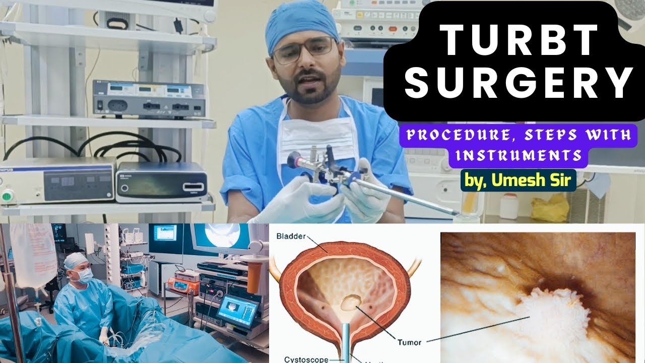 TURBT surgery instrument | TURP surgery instrument | TURBT procedure , instrument | #@Umeshsir405