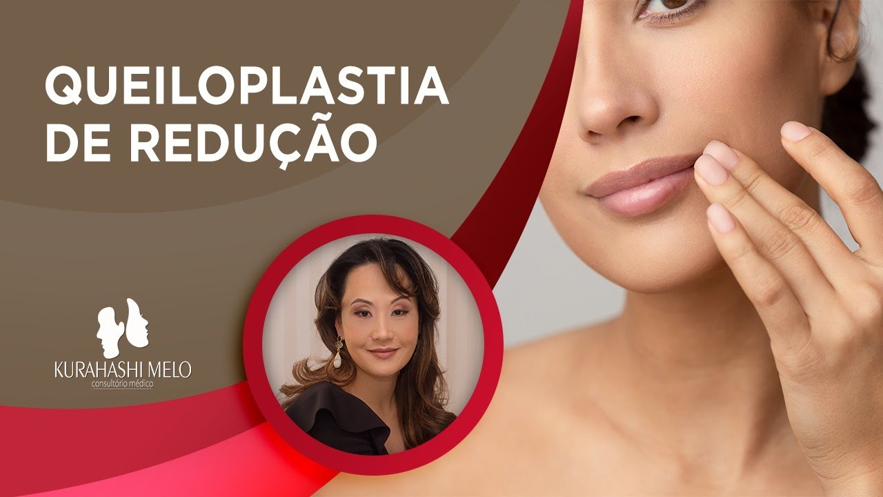 Queiloplastia de redução - Saiba tudo sobre o procedimento!