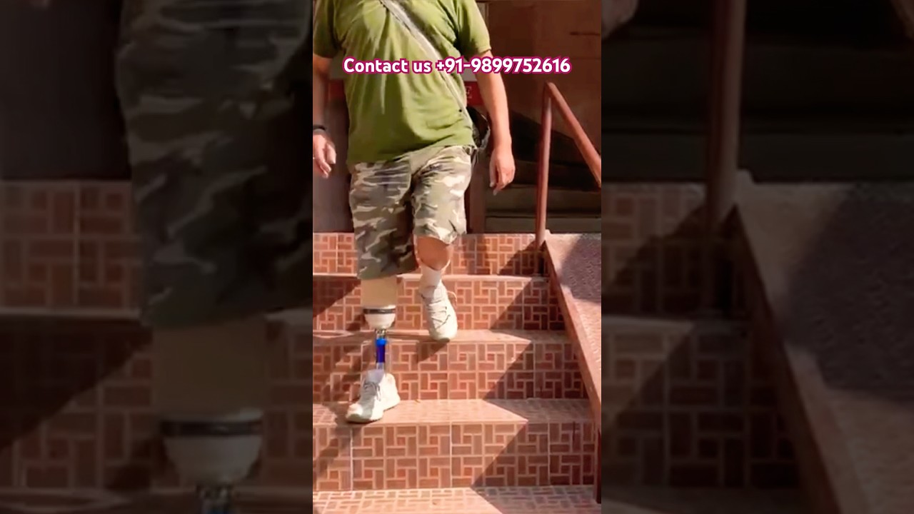 #ossur #artificiallimbcenter #belowkneeprosthesis #artificiallimb #prostheticlimb #hospital