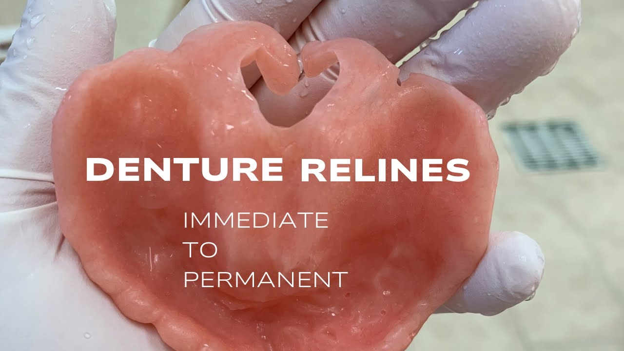 Immediate Denture/Permanent Reline
