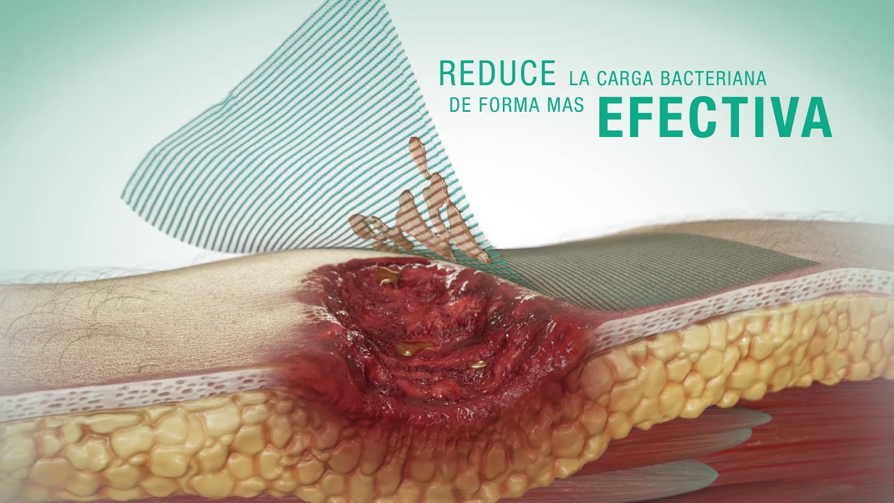 Sorbact Technology: Cutimed Sorbact - Mode of Action [Spanish]