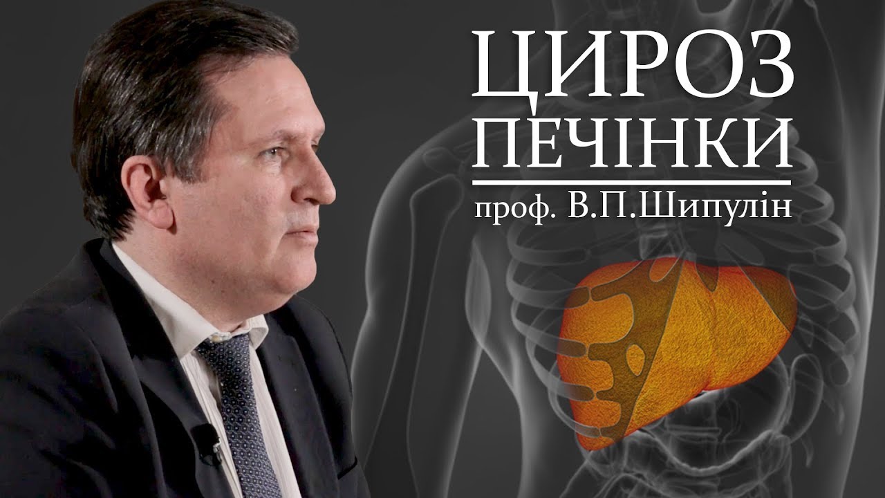 Відеолекція ЦИРОЗ ПЕЧІНКИ. Шипулін В.П.