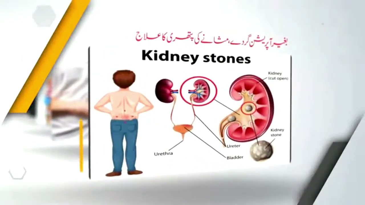DR NADEEM BIN NUSRAT | Wamiq Hospital Sahiwal