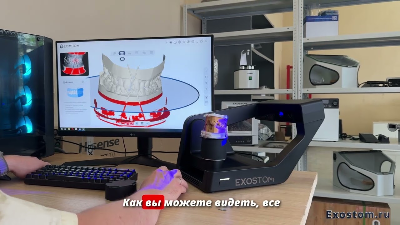 Проверка сканера Exostom RapidScan Pro