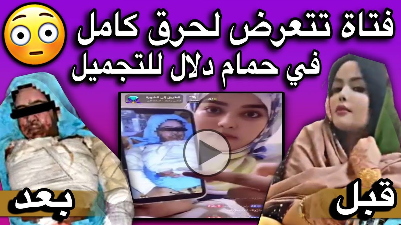 موريتانيا دعواتكم لها بالشفاء العاجل جزاكم الله خير😢💔🇲🇷