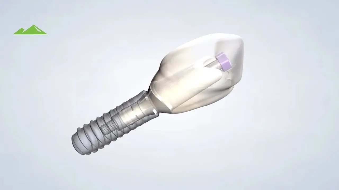 Dental Implants at Utah Surgical Arts