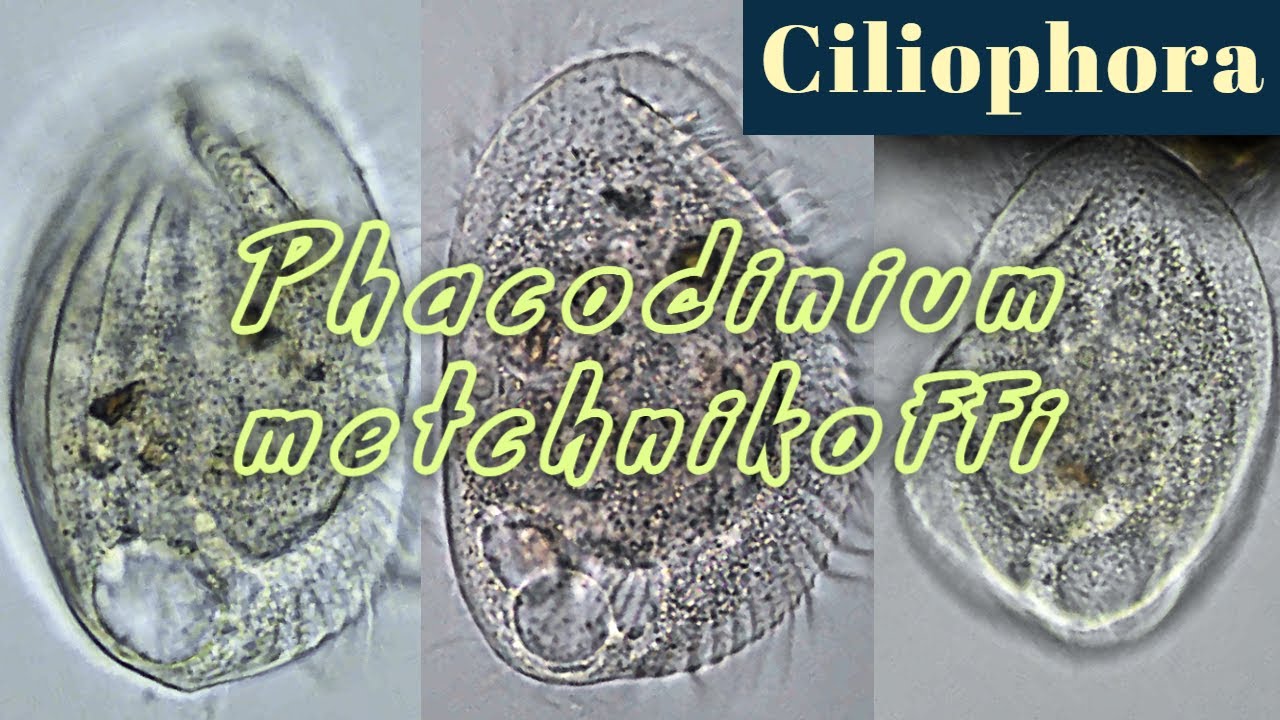 Phacodinium metchnikoffi, moss & lichens ciliate