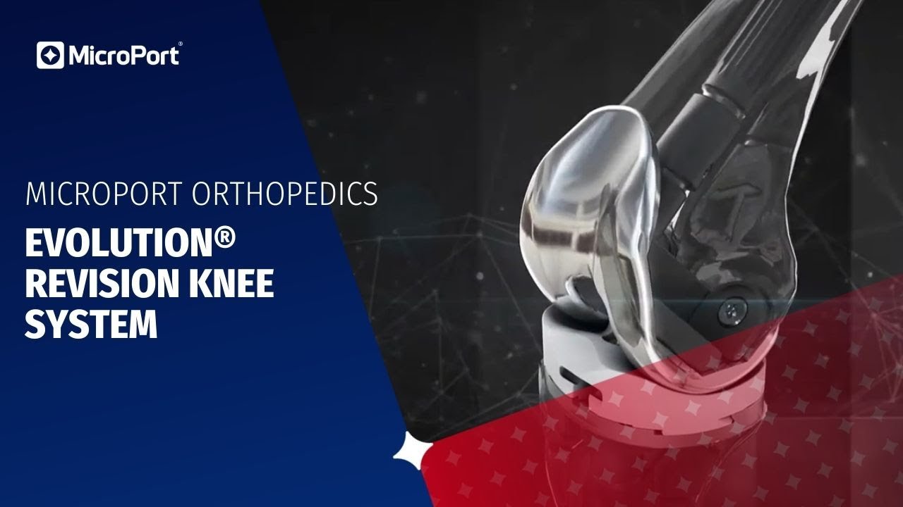 Evolution&reg; Revision Knee System