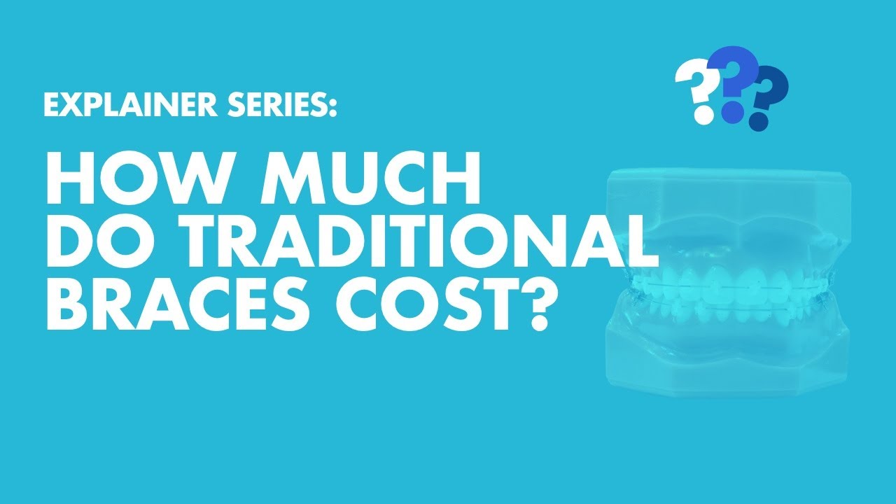 How Much Do Traditional Braces Cost? | LA Dental Clinic