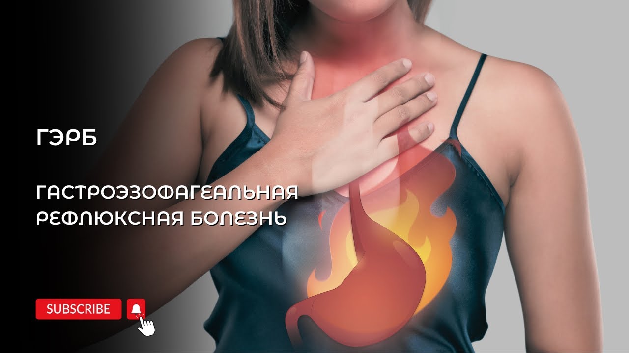 ГЄРБ.  Гастроэзофагеальная рефлюксная болезнь. Малиновская