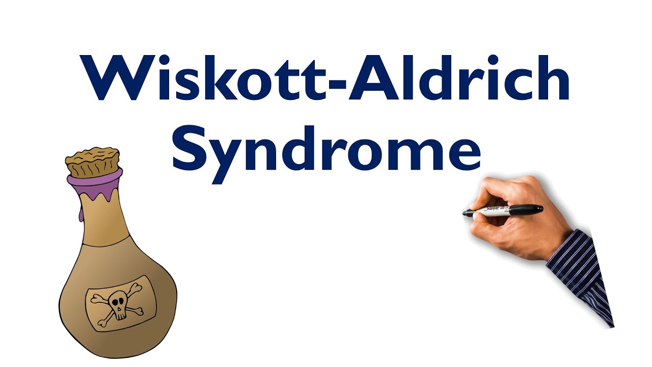 Wiskott-Aldrich Syndrome Mnemonic| STEP NCLEX COMLEX
