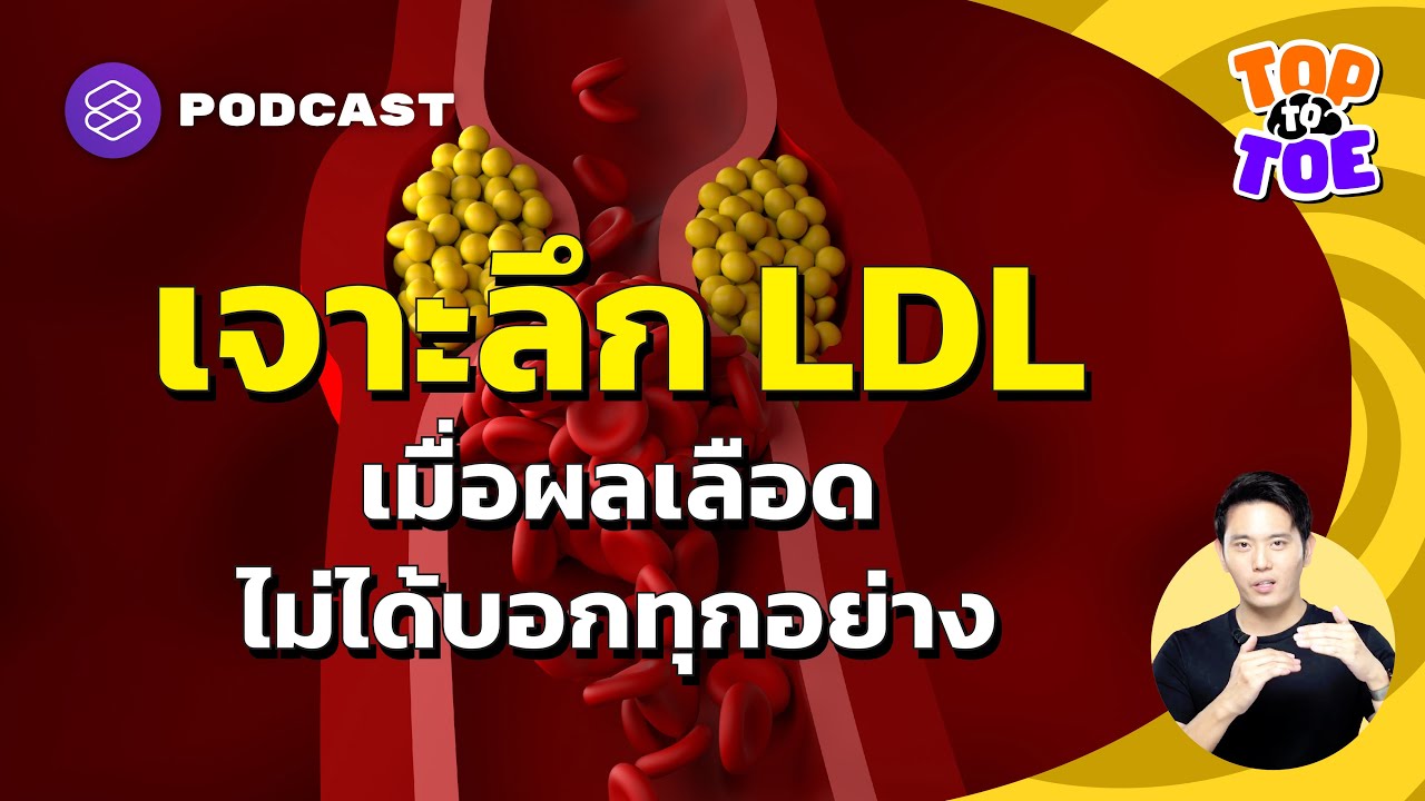 จัดการ Small Dense LDL ภัยร้ายโรคหัวใจ | Top to Toe EP.76