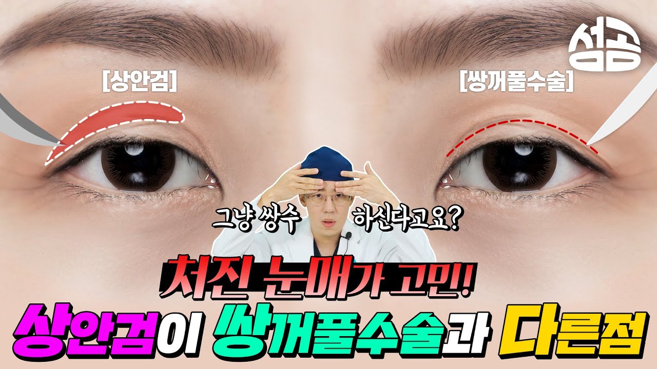 쌍꺼풀VS상안검 차이점 3가지. 상안검 알고 하셔야 해요. #쌍꺼풀수술 #상안검수술 #눈성형
