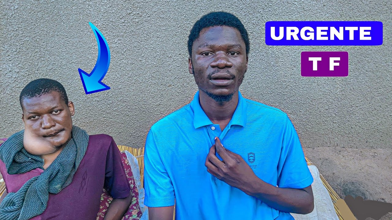 Os Médicos tomaram essa decisão com tumor de Elias em Moçambique África 