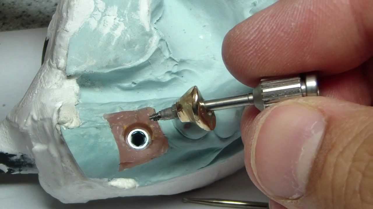 Ahh....Stripped Implant Abutment Screw
