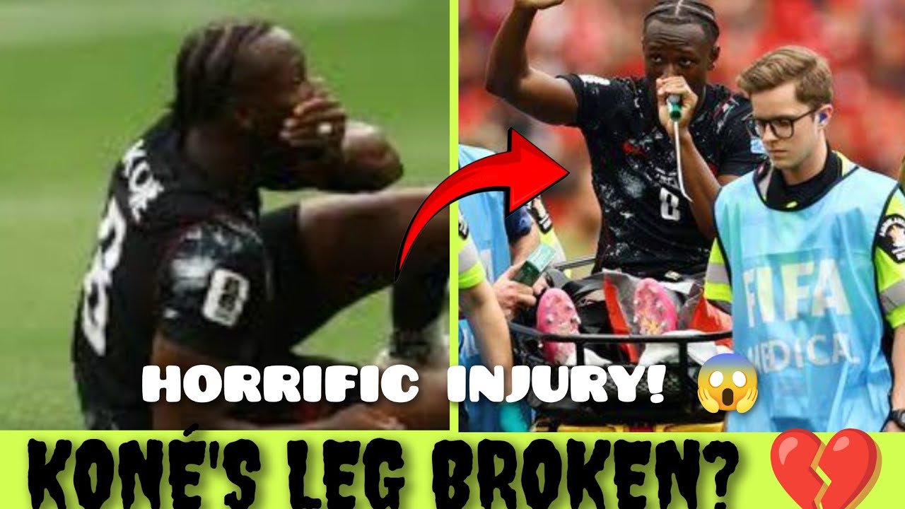 Canada Star Isma&euml;l Kon&eacute; Injury Today Breaks Leg In Shocking World Cup Incident 2026