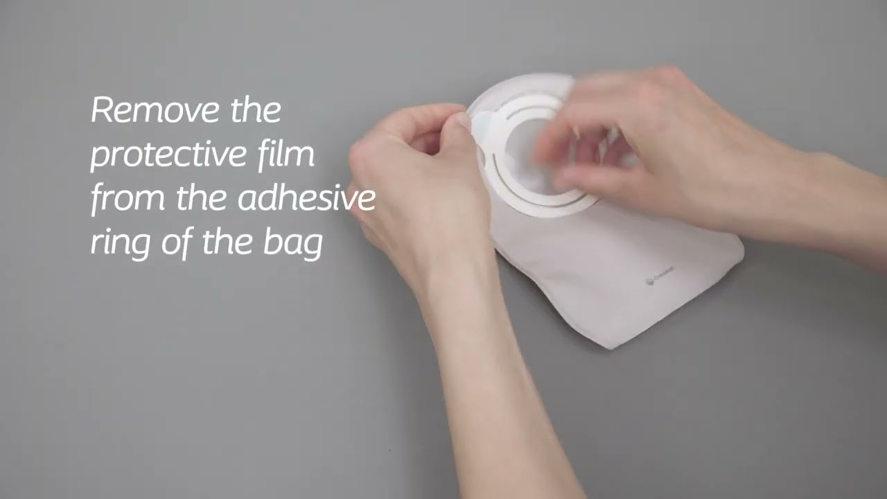 SenSura® Mio Kids 2 piece Urostomy (How to Video)