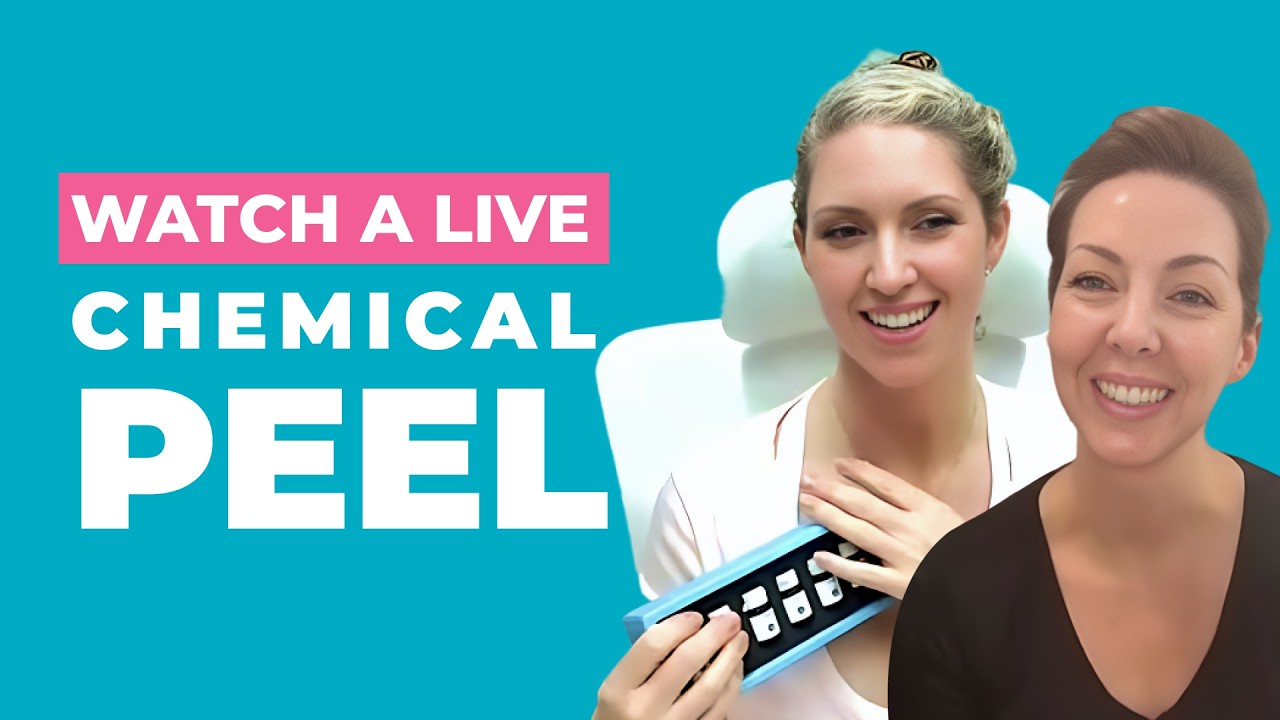 LIVE TCA 13% Peel: Real-Time Layers, Frosting Cues + Aftercare