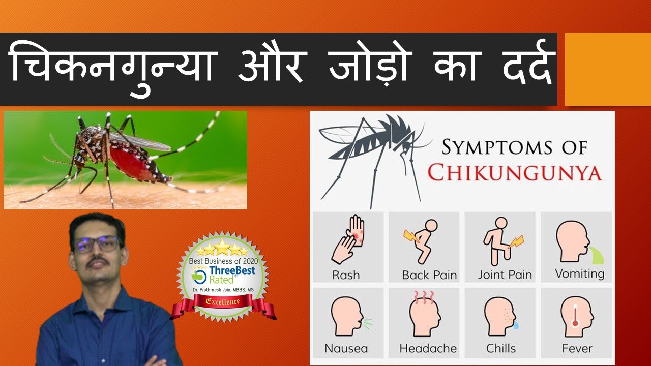 Chikangunya Arthritis , Joint Pains in  Hindi चिकनगुन्या और जोड़ो का दर्द Post Viral Joint Pain