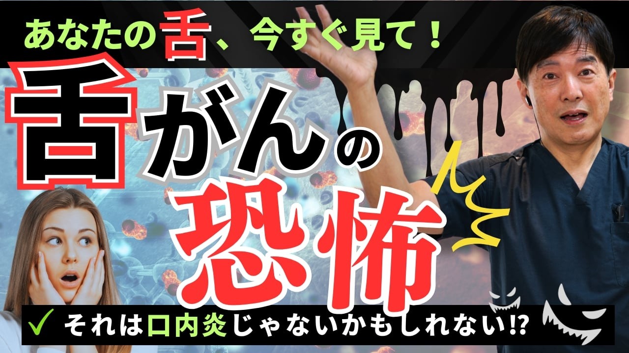 【舌がん】の恐怖！口内炎じゃないかも知れません？　岡山の歯科医師が舌がんの早期発見について解説します