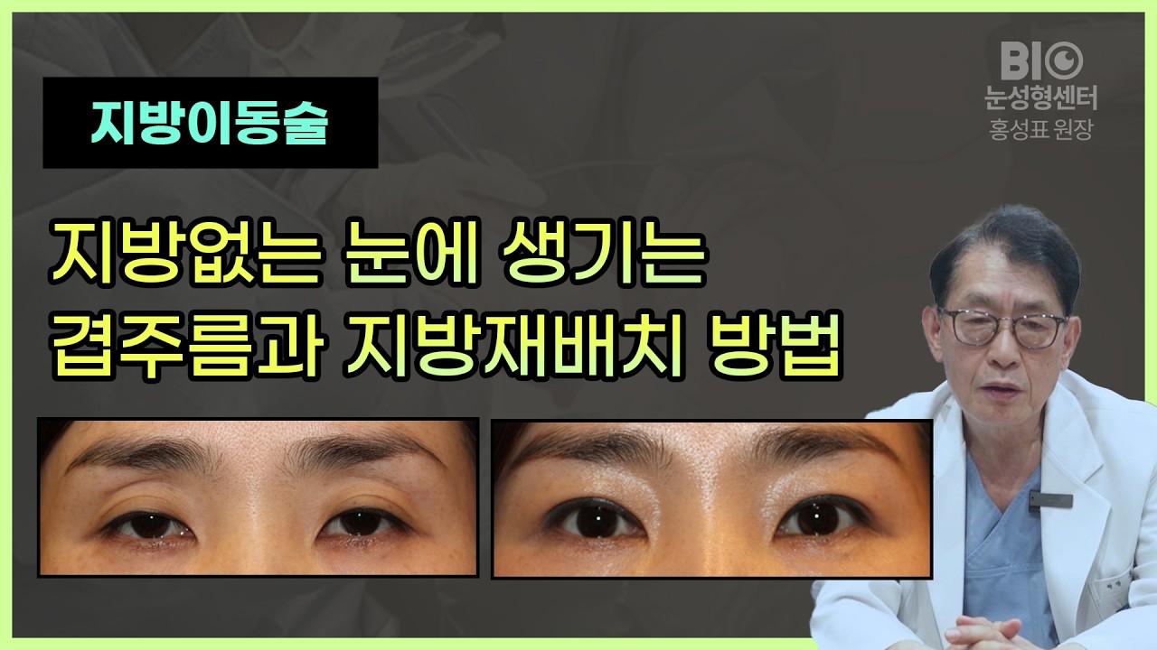 지방없는 눈에 생기는 겹주름과 지방재배치 방법 [BIO성형외과 홍성표원장]