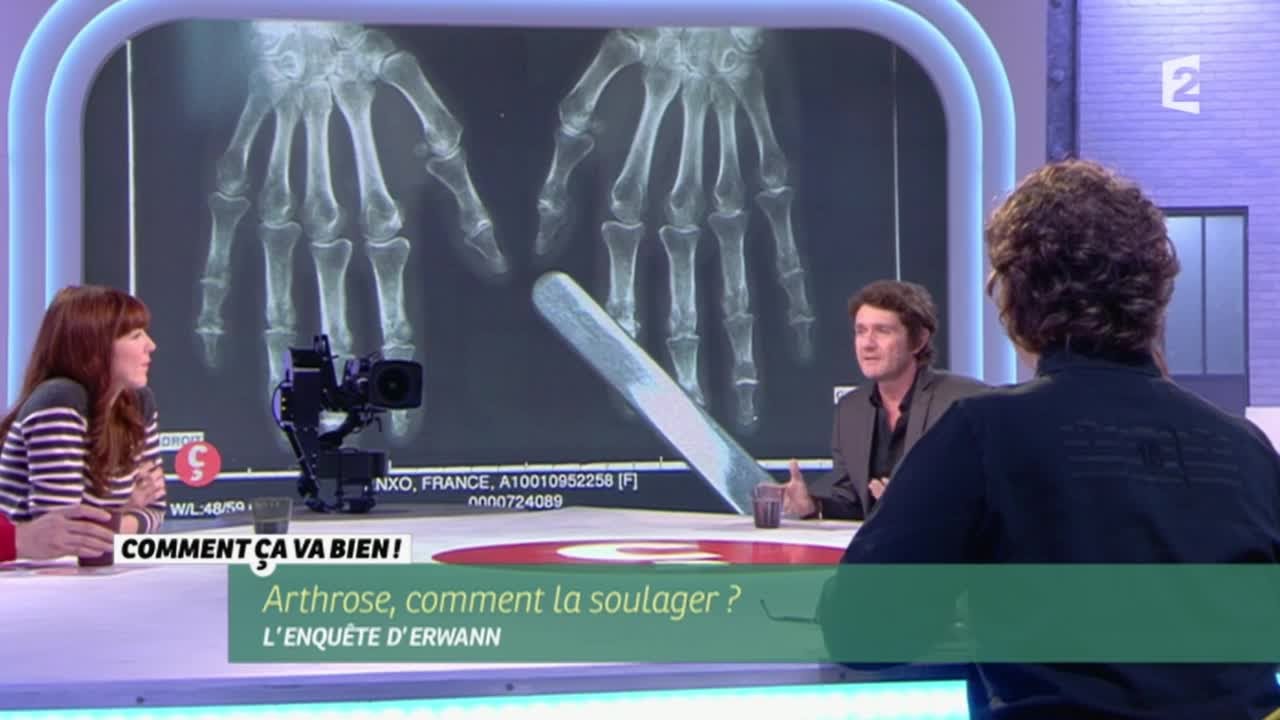 [SANTE] Comment soulager l'arthrose? #CCVB