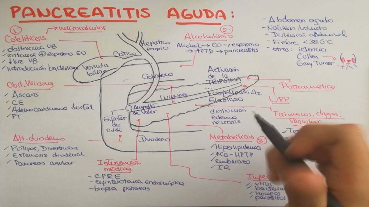 Pancreatitis: causas, fisiopatología, clínica, diagnóstico y tratamiento