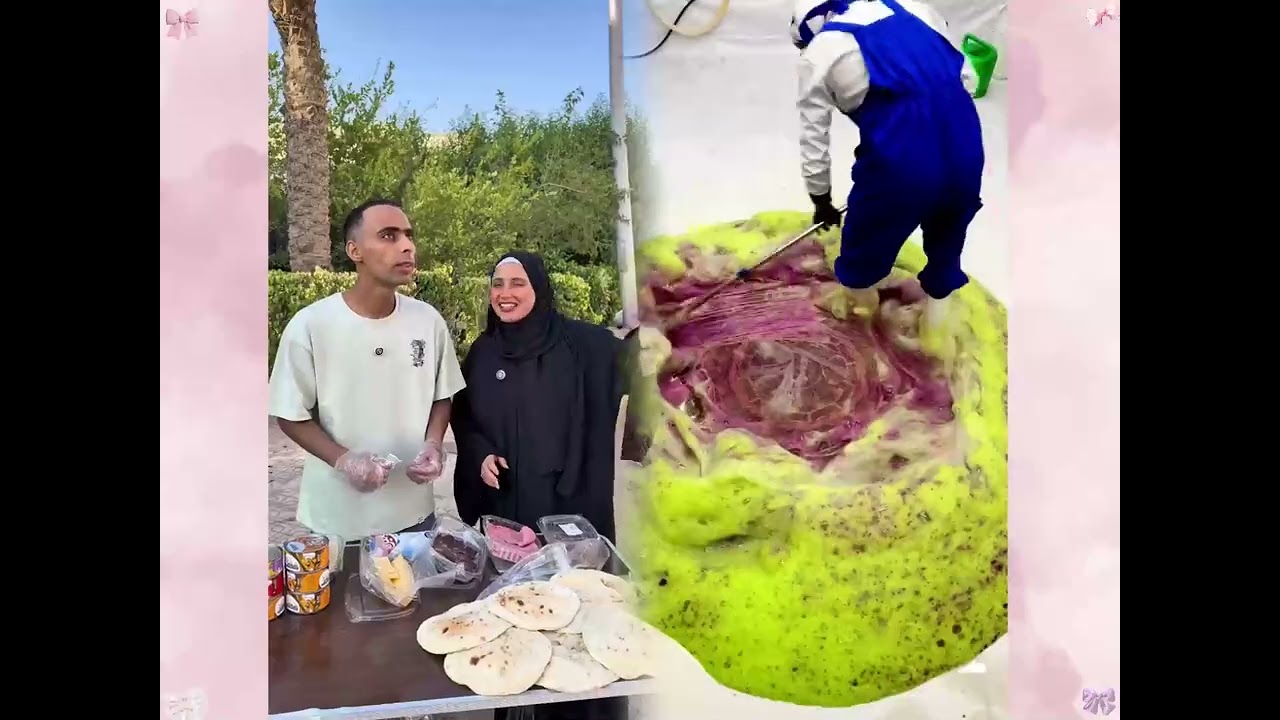 #الطفل الاعمى المعجزه #محضوره_من_الاكسبلور_والمشاهدات #علاوي_مارتن #اكسبلور 15_w (4)