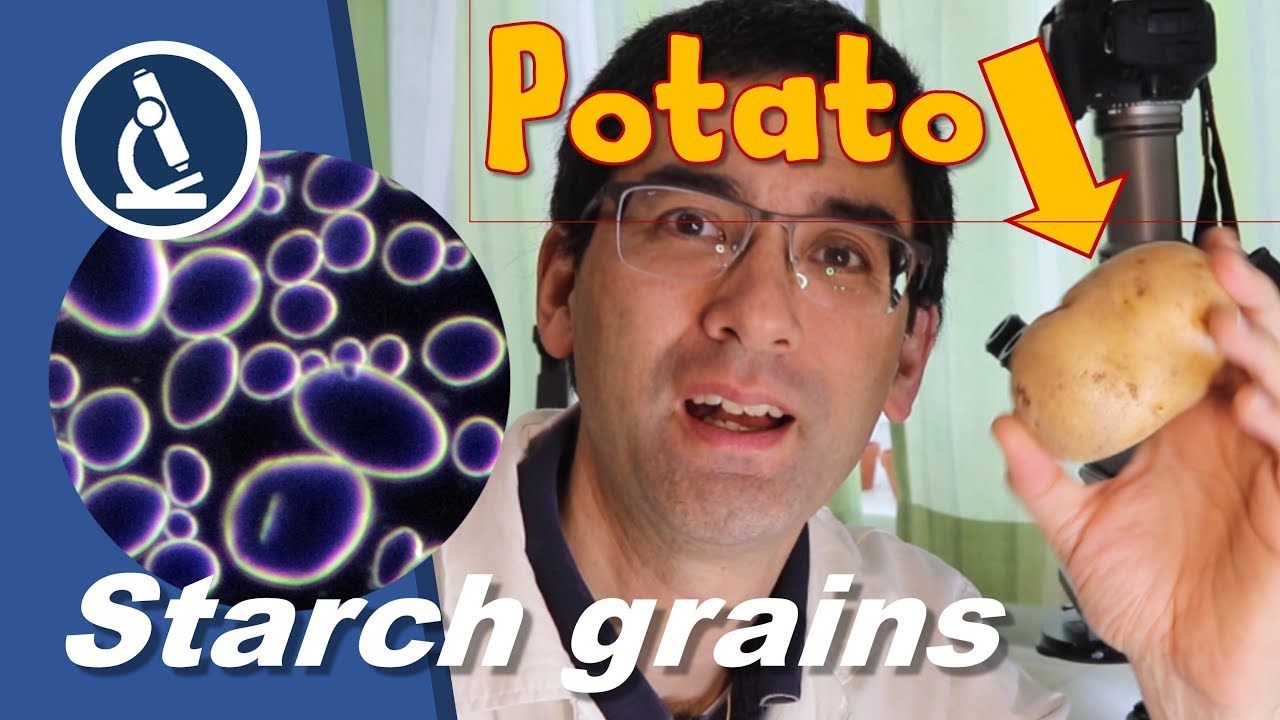 How to look at Potato starch grains under the microscope