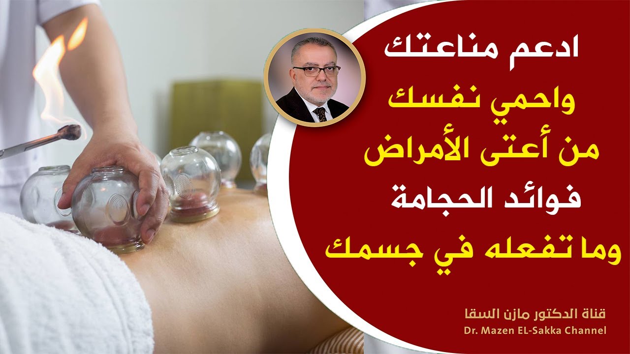 وداعا لسموم الجسم | فوائد العلاج بالحجامة التي أكدها العلم الحديث الأمراض التي تعالجها ومحاذير عملها