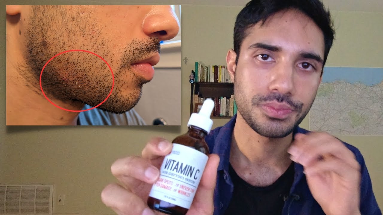7 Mistakes You're Making with Vitamin C