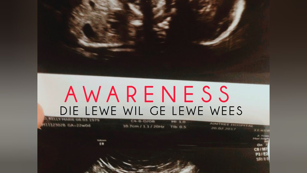 Capital L Kapitaal ft Chessy HD - Lewe Wil Gelewe Wees (official track)