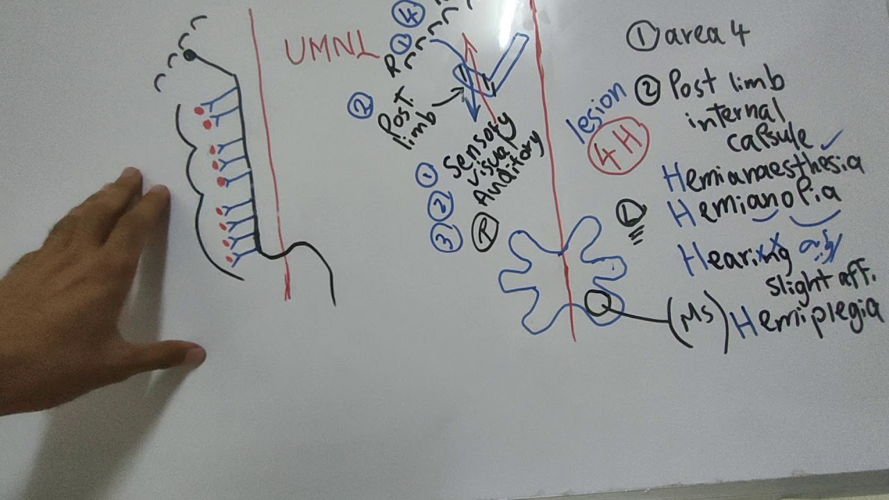 #Motor_CNS_Dr_Mohamed_Fayez UMNL continuation + Spinal Shock + Stage of Recovery