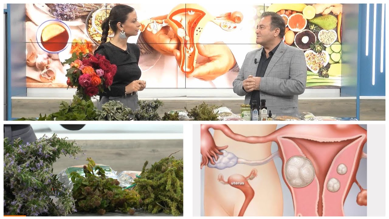 'Mishi i huaj' në mitër/ Ja si të shpëtoni nga miomat pa kirurgji me kurën natyrale nga Ylli Merja