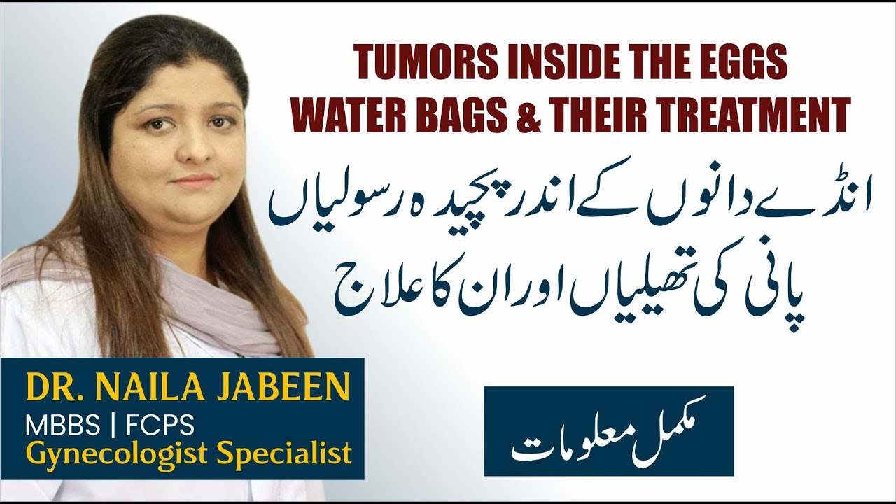 Ovarian Cyst | Complex Fibroid | Ande Dani Mein Rasoli | Reham Mein Pani Ki Theli Ka Ilaj in (Urdu)