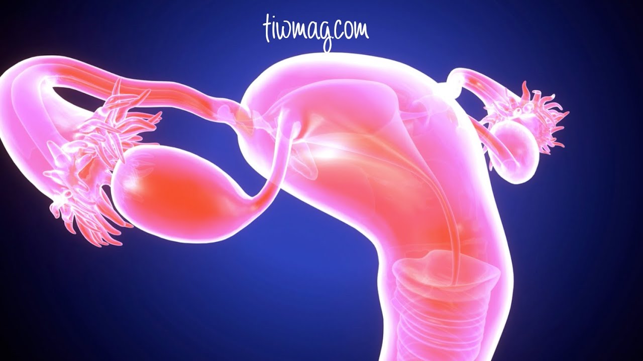 Fallopian Tube Abnormalities Are Present In 25% &ndash; 35% OF All Infertile Women