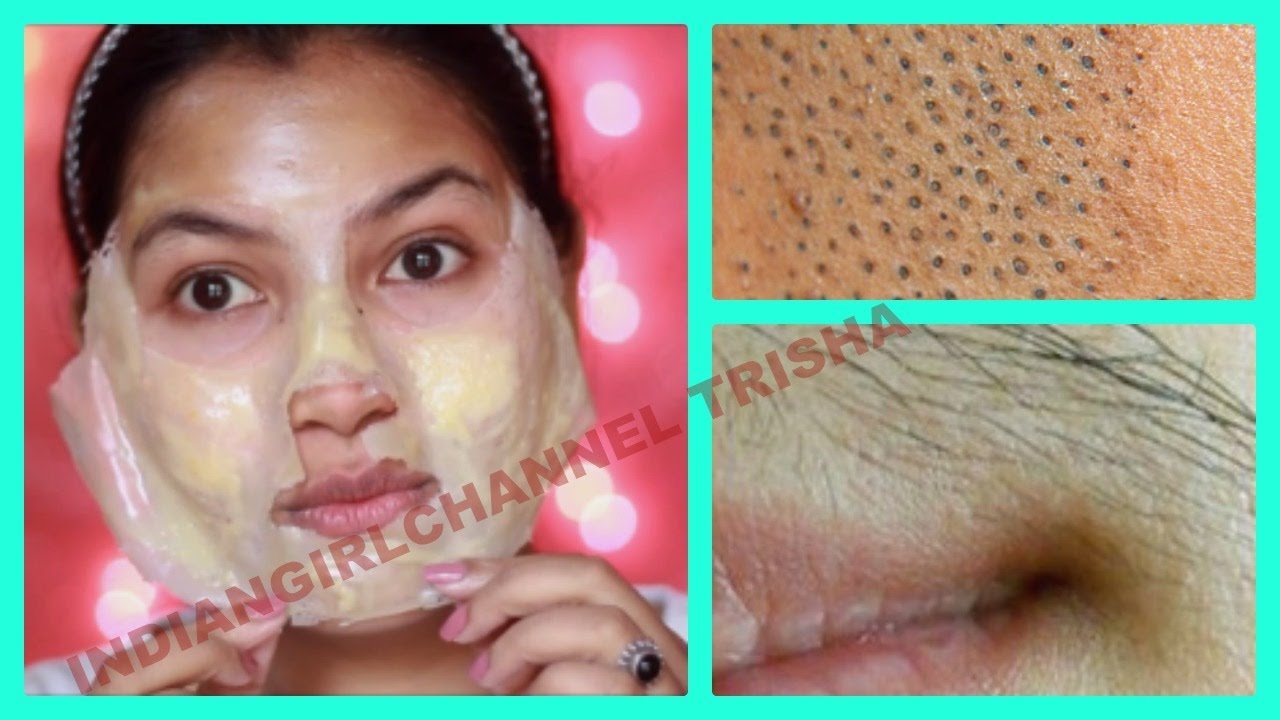 Remove  Unwanted Facial Hair, Blackheads & Whiteheads at Home/get clear skin/orange peel off mask