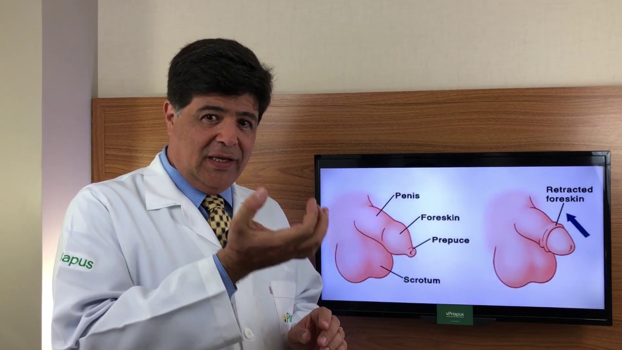 FIMOSE - POSTECTOMIA OU CIRCUNCIS&Atilde;O