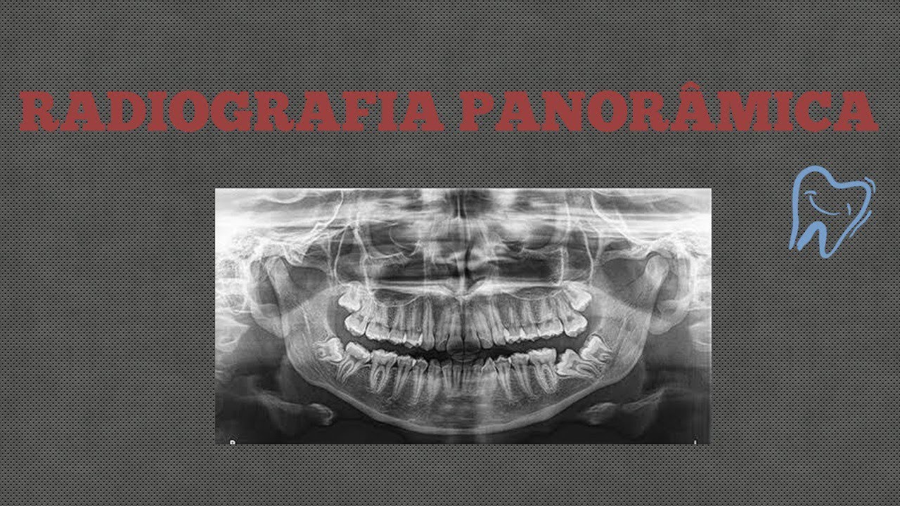 RADIOGRAFIA PANORÂMICA - PASSO A PASSO
