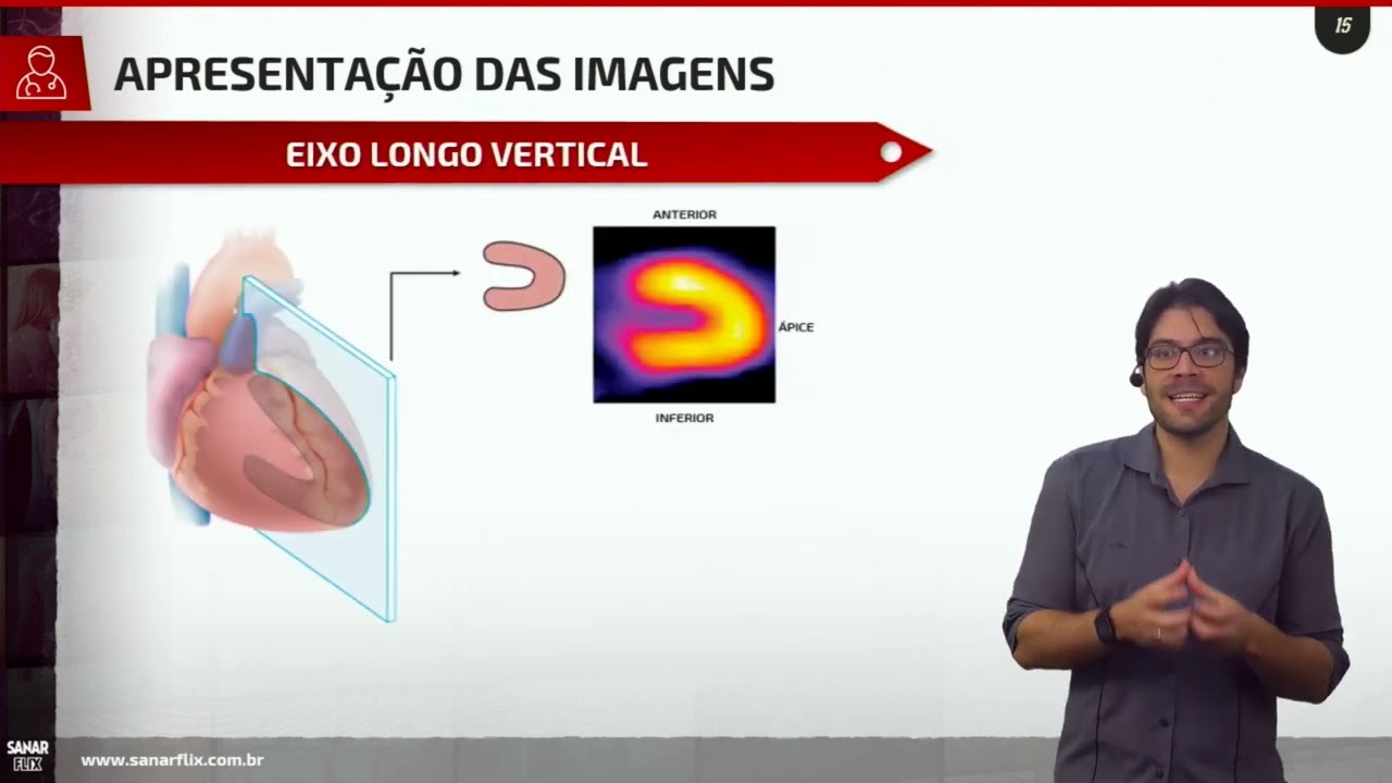 Aula   Cintilografia de Perfusão do Miocárdio #Aprenda