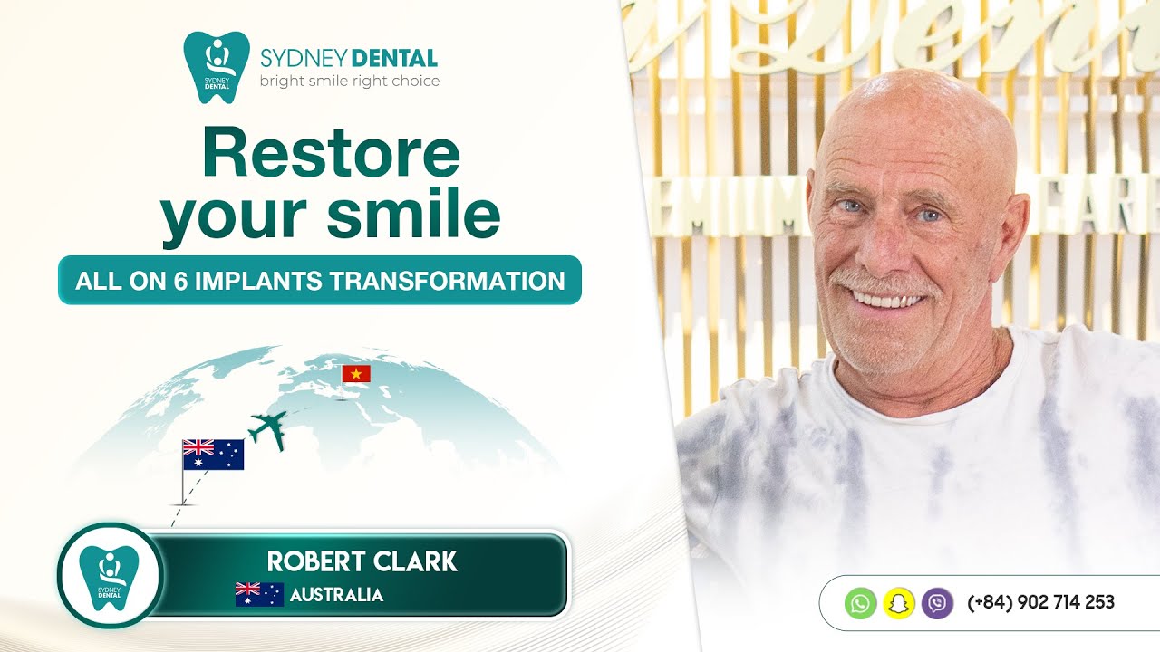 Restore Your Smile with All-on-6 Implants