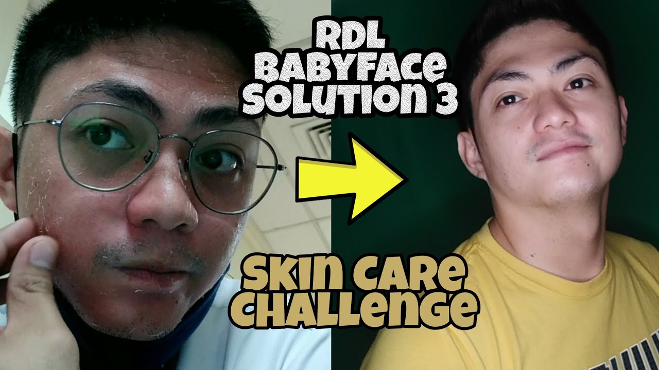 GLASS SKIN? | RDL Baby Face Solution 3 (P36.75  LANG!) | PART 1